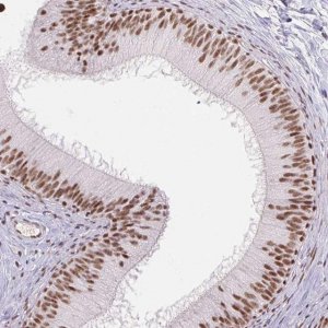 Anti-DDX17 antibody produced in rabbit 