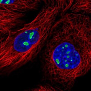 Anti-DDX18 antibody produced in rabbit HPA041056-100UL