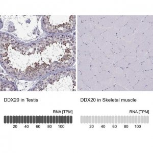 Anti-DDX20 antibody produced in rabbit 