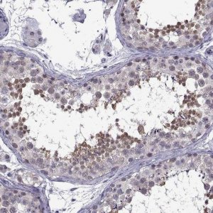 Anti-DDX20 antibody produced in rabbit 