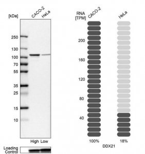 Anti-DDX21 antibody produced in rabbit 