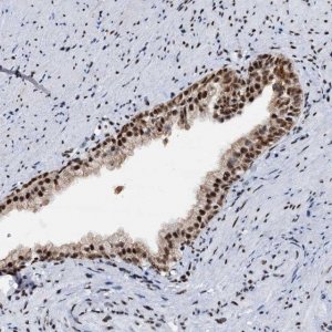 Anti-DDX23 antibody produced in rabbit 