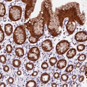 Anti-DDX28 antibody produced in rabbit 