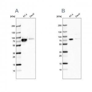 Anti-DDX3X antibody produced in rabbit 