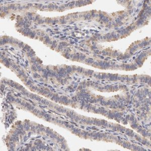 Anti-DDX3X antibody produced in rabbit 