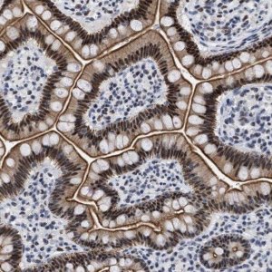 Anti-DDX41 antibody produced in rabbit 