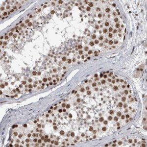 Anti-DDX42 antibody produced in rabbit 