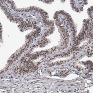 Anti-DDX42 antibody produced in rabbit 