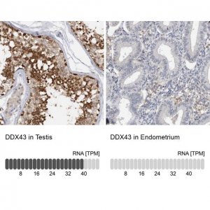 Anti-DDX43 antibody produced in rabbit 