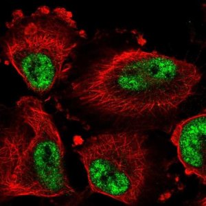 Anti-DDX46 antibody produced in rabbit HPA057501-100UL