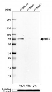 Anti-DDX5 antibody produced in rabbit HPA020043-100UL