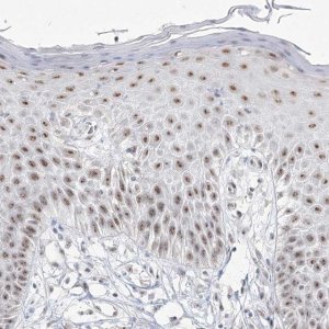 Anti-DDX50 antibody produced in rabbit HPA037388-100UL