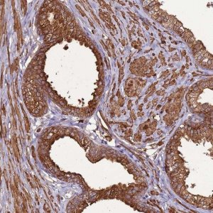 Anti-DDX59 antibody produced in rabbit 