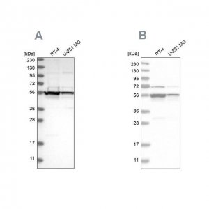 Anti-DDX6 antibody produced in rabbit 