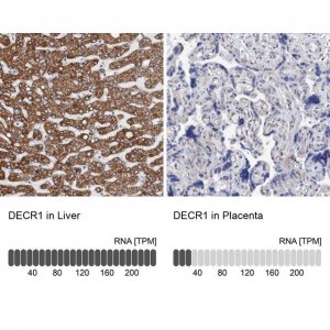 Anti-DECR1 antibody produced in rabbit HPA023238-100UL