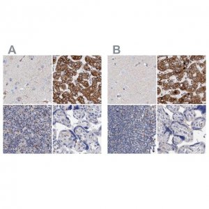 Anti-DECR1 antibody produced in rabbit HPA023238-100UL