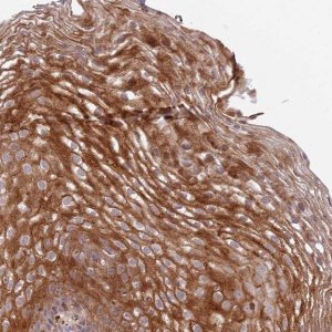 Anti-DEFB125 antibody produced in rabbit 