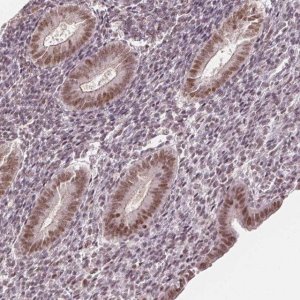 Anti-DEK antibody produced in rabbit 
