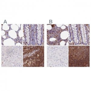 Anti-DENND1C antibody produced in rabbit 
