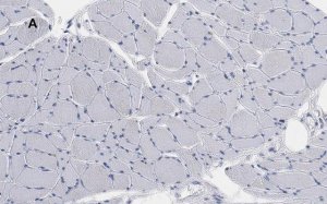 Anti-Desmin Antibody, clone 1H16, ZooMAb Rabbit Monoclonal 