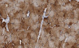 Anti-Desmin Antibody, clone 1H16, ZooMAb Rabbit Monoclonal 