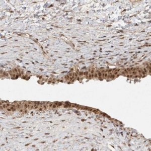 Anti-DFFA antibody produced in rabbit 