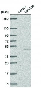 Anti-DFNB59 antibody produced in rabbit 