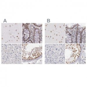 Anti-DGCR14 antibody produced in rabbit HPA001222-100UL