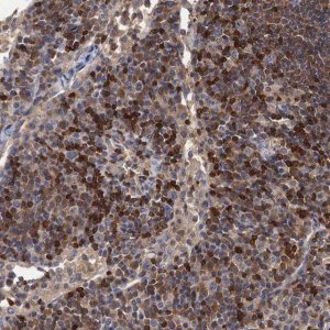 Anti-DGKA antibody produced in rabbit 