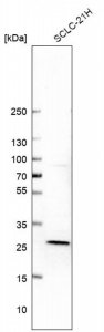 Anti-DGUOK antibody produced in rabbit HPA034766-100UL