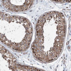 Anti-DGUOK antibody produced in rabbit HPA034766-100UL