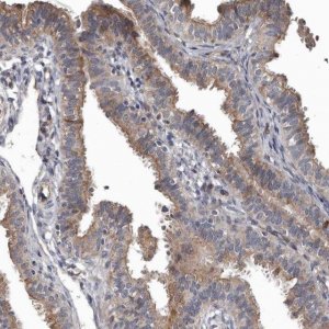 Anti-DHPS antibody produced in rabbit 