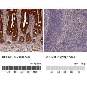Anti-DHRS11 antibody produced in rabbit 