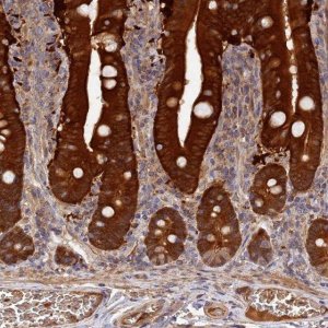 Anti-DHRS11 antibody produced in rabbit 