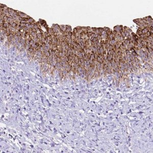 Anti-DHRS2 antibody produced in rabbit 