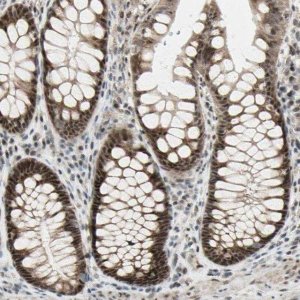 Anti-DHRS7B antibody produced in rabbit 