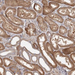 Anti-DHRS9 antibody produced in rabbit 