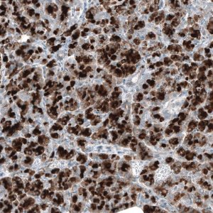 ANTI-DHRSX antibody produced in rabbit 