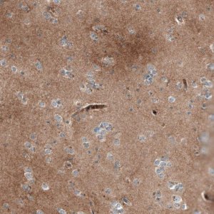 ANTI-DHRSX antibody produced in rabbit 