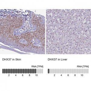 Anti-DHX37 antibody produced in rabbit 