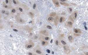 Anti-DHX37 Antibody, clone 3I16 ZooMAb Rabbit Monoclonal 