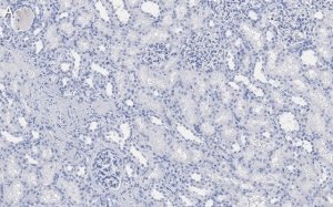Anti-DIP2B Antibody, clone 2C8, ZooMAb Rabbit Monoclonal 