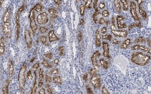 Anti-DIP2B Antibody, clone 2C8, ZooMAb Rabbit Monoclonal 