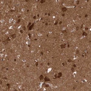 Anti-DIP2C antibody produced in rabbit 