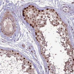 Anti-DIS3 antibody produced in rabbit 