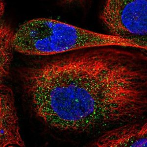 Anti-DIXDC1 antibody produced in rabbit 