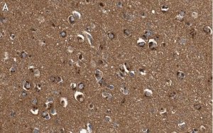 Anti-DKK3 Antibody, clone 3H17 ZooMAb Rabbit Monoclonal 