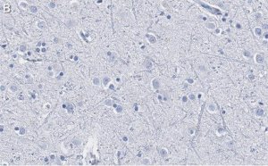 Anti-DKK3 Antibody, clone 3H17 ZooMAb Rabbit Monoclonal 