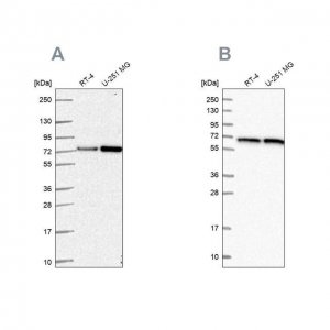 Anti-DLAT antibody produced in rabbit HPA062766-100UL