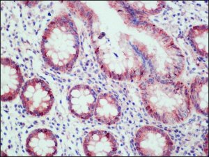 Anti-DLC1 (C-terminal region) antibody produced in rabbit SAB4200490-200UL
